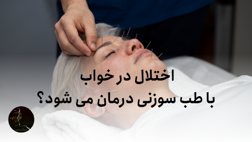 اختلال در خواب با طب سوزنی درمان میشود؟