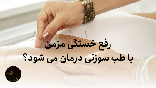 رفع خستگی مزمن با طب سوزنی درمان میشود؟